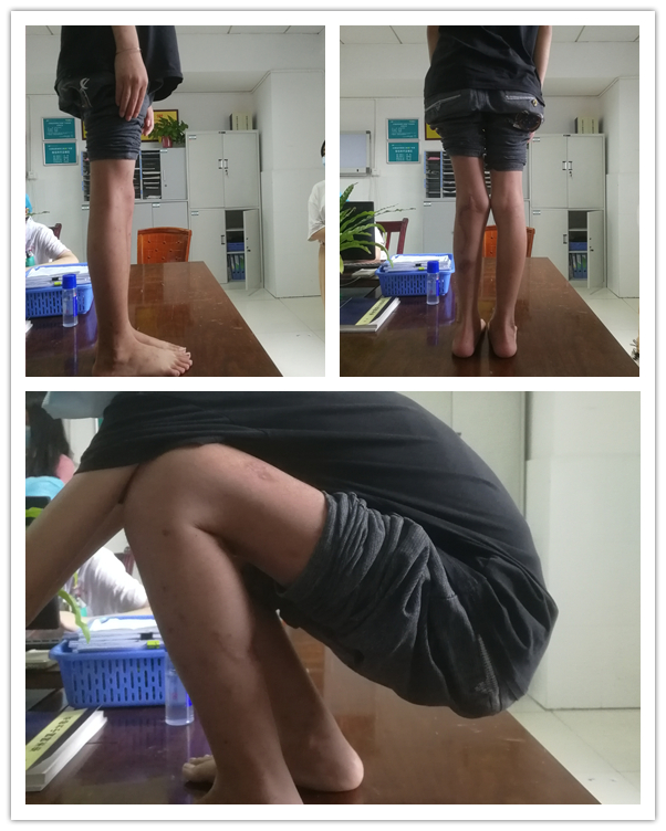 小儿骨科.jpg