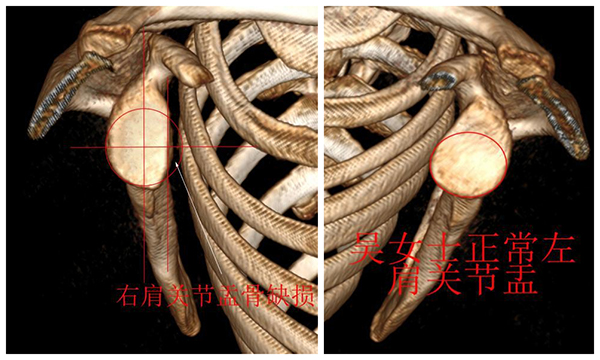 术前CT.jpg
